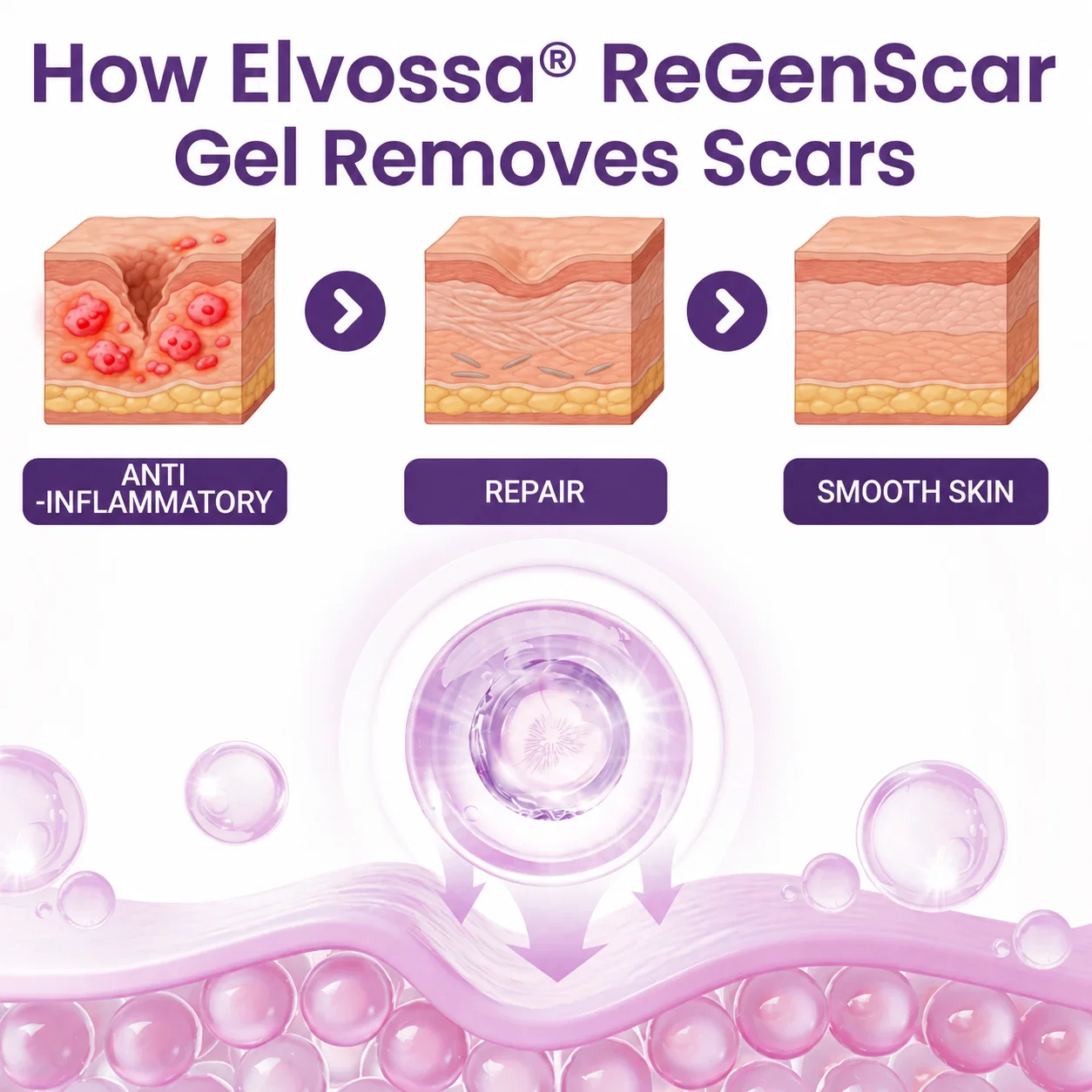 Elvossa® ReGenScar Stem Cell Scar Gel - Image 3